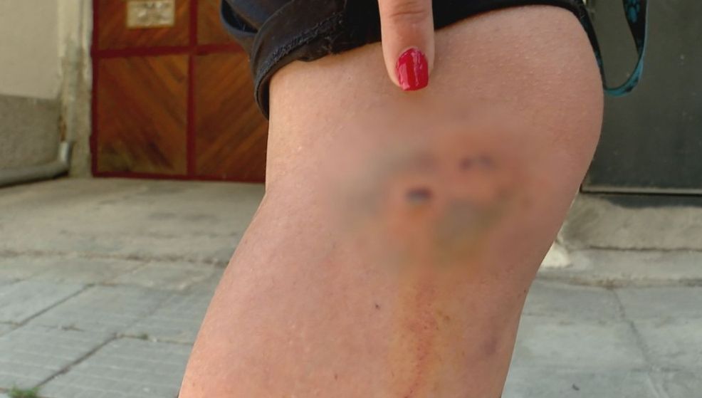 Нападение на питбул